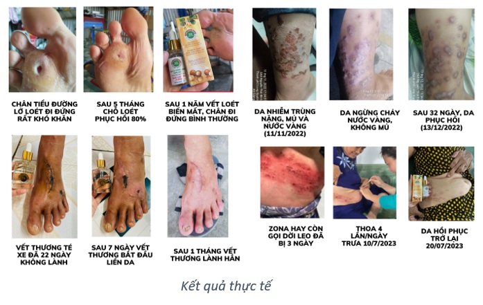 tinh chiet mắc ca duong xuan qua cuu tinh cho da va toc 2