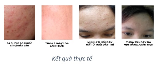 tinh chiet mắc ca duong xuan qua cuu tinh cho da va toc 3