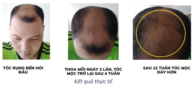 tinh chiet mắc ca duong xuan qua cuu tinh cho da va toc 4