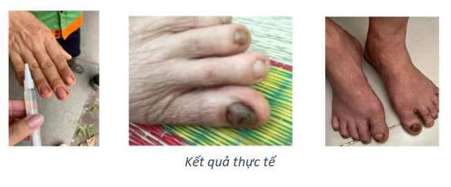 tinh chiet mắc ca duong xuan qua cuu tinh cho da va toc 5